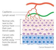 Where did i come from?: How Cancers Grow Cancer Research Uk