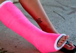 Image result for Short Leg Cast