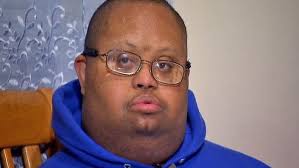 1 and a significant increase in overall life expectancy. Pin On Down Syndrome