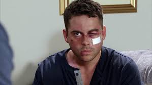 Drama hits the coronation street set as an extra collapses while filming an attack scene involving the supporting actor was filming scenes with character todd grimshaw (played by bruno langley) on. Todd S Scars Will Never Heal In Corrie Coronation Street Photos What S On Tv