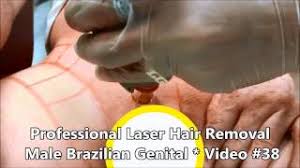 The brazilian covers the front of the pubic region, under the intimate areas and up the back of the thong line. Professional Laser Hair Removal Male Brazilian Genital Video 38 Youtube