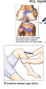 Check spelling or type a new query. Clinical Correlations Lower Limb Flashcards Quizlet