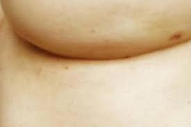 Some warning signs of breast cancer are— new lump in the breast or underarm (armpit). My Left Boob Twitter Account Is Sharing Breast Cancer Warning Sign That Few Know Stuff Co Nz