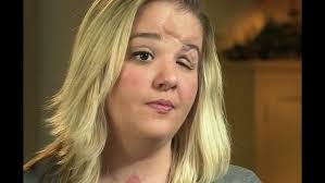 Girl's life-changing story is heart-wrenching reminder not to text and  drive