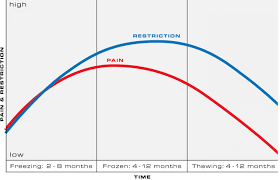 Image result for Frozen Shoulder