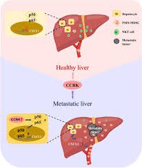 Liver medicine refers to all diagnostic and treatment strategies of diseases and conditions that cause liver failure directly or indirectly. Cell Cycle Related Kinase Reprograms The Liver Immune Microenvironment To Promote Cancer Metastasis Cellular Molecular Immunology