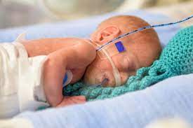 We did not find results for: Parto Prematuro De 26 Semanas Una Carrera De Fondo Baby Suite By Pau