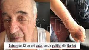 Politistul violent care l-a snopit în bãtaie pe Ghimus, si-a gãsit nasul!