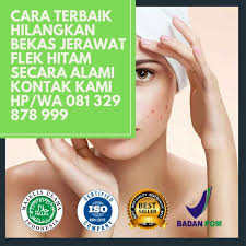 Cara Alami Menghilangkan Bekas Jerawat Jerawat Obat Jerawat Spirulina