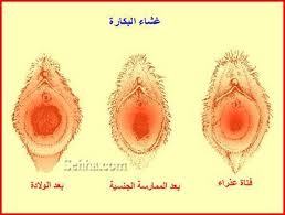 كيف اعرف اني عذراء بطرق بسيطة بالصور الجواب