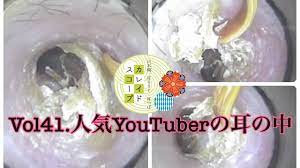 耳そうじ】Vol41. 人気YouTuberの耳の中！？極細耳かきでパリパリ剥がします(^^)earcleaning &headspa salon  KALEIDSCOPE TOKYO - YouTube
