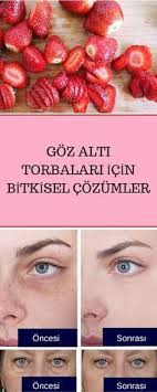 Goz Alti Torbalarina Artik Elveda Diyebilirsiniz Homemade Beauty Care Homemade Skin Care Health And Beauty