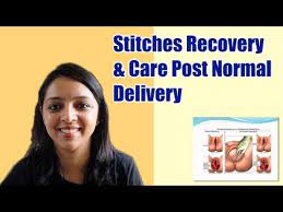 If you cannot sew within 12 hours, and the woman has a 1st or 2nd degree tear, do not sew it. Post Normal Delivery Stitches Recovery Care Tips Youtube