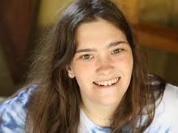 Disability and beauty: Rick Guidotti's photos challenge perceptions