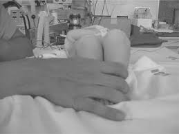 Image result for Galeazzi Sign