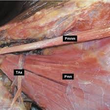 How to build chest muscle fast. Dissection Of Right Pectoral Region Showing Pectoralis Minimus Muscle Download Scientific Diagram