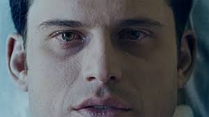 Forever Changing the Recovery Outcome of Spinal Cord Injury