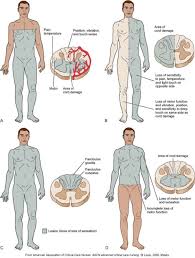 Exam 2 Spinal Cord Injury Diagram Quizlet