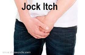 Jock Itch Causes Symtoms Treatment And Prevention