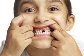 Check spelling or type a new query. Gigi Palsu Solusi Gigi Ompong Dental Id