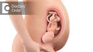 What Is Low Lying Placenta Its Causes Dr Lalitha Sudha Alaparthi Youtube