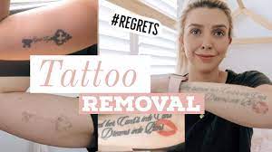 The number of sessions needed for a complete tattoo removal has decreased thanks to this invention. Laser Tattoo Removal Before After Best Laser Cost Pain And Why I M Removing Them Youtube