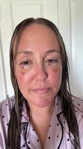 Jennifer Barlow Recovery