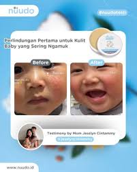 Pernah ga sih moms penasaran sama kulit si Kecil? Kok bisa lembut banget,  kenyal, dan glowing juga? 🤔 Biar ga penasaran lagi, moms bisa swipe gambar  slide diatas yaa 😉✨ Kita bantu