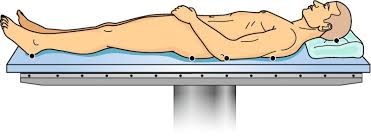We did not find results for: Fig 12 1 Supine Position With Typical Pressure Points Compartment Syndrome Ncbi Bookshelf