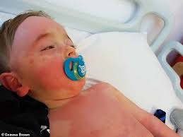 La maladie ou syndrome de kawasaki est une artérite inflammatoire d'origine inconnue qui touche habituellement les jeunes enfants de moins de 5 ans. La Maladie De Kawasaki Affectant Les Enfants Est Causee Par Le Coronavirus Fr24 News France
