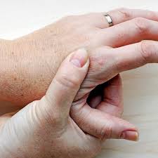 Voorlopige teamindeling senioren bekend 04/07/2021. Handschmerzen Richtig Behandeln Ndr De Ratgeber Gesundheit