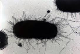 Coli is among the most common causative agents of utis. E Coli Superbug Strains Can Persist In Healthy Women S Guts Newsroom