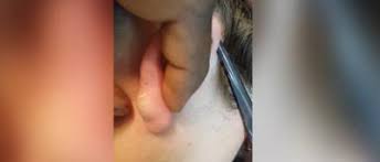 Julia et melvin font partie d'une équipe de détectives qui ont pour mission d'enquêter sur. Oserez Vous Regarder Jusqu Au Bout Il Veut Peter Le Bouton Sur L Oreille De Sa Petite Amie Video Sudinfo Be