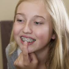 THE BEST 10 ORTHODONTISTS near CHEAT LAKE, WV