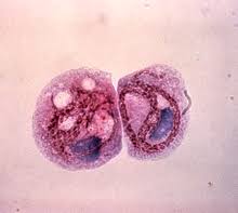 Where do legionella bacteria come from? Legionella Pneumophila Wikipedia