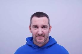 Emmerdale's Anthony Quinlan opens up about his 'life changing' hair  transplant surgery