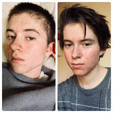 Pre T Vs 6 Months On T Please Validate Me This Hormonal Acne Has Me Feeling Like An Ugly Boy Ftm Selfies Handsome boy stock photos and images. pre t vs 6 months on t please validate