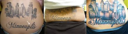 259 likes · 229 were here. Benchmark Tattoo Fade Away Laser Tattoo Removal 1831 E 8th St G102 Duluth Mn 55812