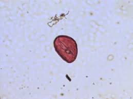 Image result for Melastomastrum segregatum