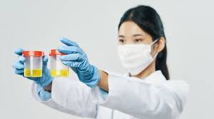 Pernahkah anda terkejut karena warna kencing anda berubah tak lagi kuning pucat melainkan jadi merah muda? Catat Ini 6 Karakteristik Urine Yang Tidak Normal