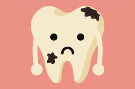88 koleksi gambar kartun anak sakit gigi gratis terbaik gambar. Gigi Berlubang Pengertian Gejala Penyebab Faktor Risiko Diagnosis Pengobatan Dan Efek Samping Pencegahan Kapan Harus Ke