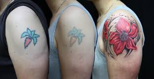 Mild infections can be treated within two weeks, while more severe cases may require several months of antibiotic treatment, says dr. How Long Does Laser Tattoo Removal Take Vanish Laser Clinic Alexandria Va