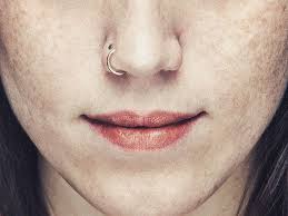  A close-up of a fully healed nose piercing, showing smooth, healthy skin without any signs of scarring or keloids.
