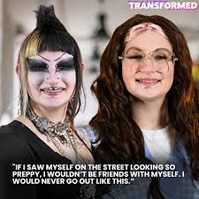 We had to remove my piercings with pliers 😳