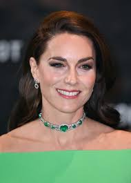 Kate Middleton, sosta americana dal medico estetico?