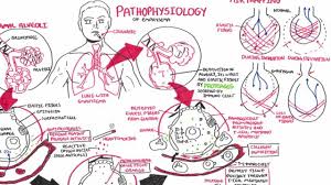 Emphysema Pathophysiology Copd