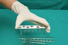Placas, pines, tornillos o malla de metal usados para reparar un hueso o una articulación