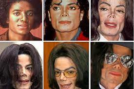 Was passierte mit seiner nase? Michael Jackson Vom Kinderstar Zum King Of Pop