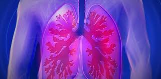 Imaginea radiologica este cred sugestiva pentru o pneumonie interstitiala ( apare accentuarea desenului hilar cu infiltratie perilobulara). Apa La Plamani Pleurezia Ce Boli Poate Ascunde Cancer360