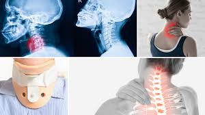 Image result for Neck Pain